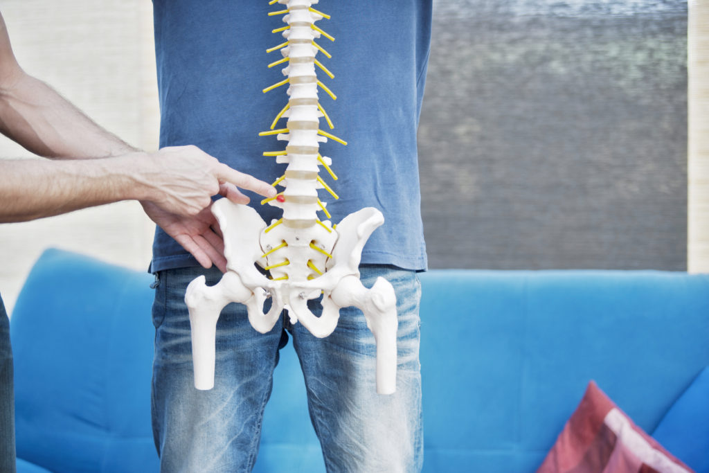 hernia chiropractie dinkelland